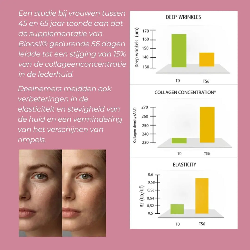 Silica Supplement (Bloosil)